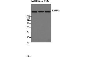 Western Blotting (WB) image for anti-Laminin, alpha 5 (LAMA5) antibody (ABIN5957135) (Laminin alpha 5 抗体)