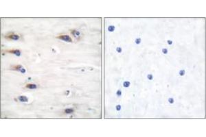 Immunohistochemistry analysis of paraffin-embedded human brain, using KSR (Phospho-Ser392) Antibody. (KSR1 抗体  (pSer404))