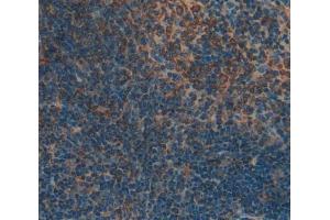 Used in DAB staining on fromalin fixed paraffin- embedded Kidney tissue (LSP1 抗体  (AA 126-330))