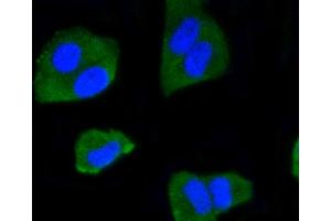 HeLa cells were fixed in paraformaldehyde, permeabilized with 0. (IRF1 抗体)
