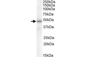 SERPINA12 polyclonal antibody  (0. (SERPINA12 抗体)