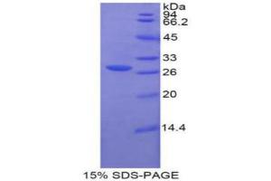 SDS-PAGE analysis of Human Glucuronidase beta Protein. (Glucuronidase beta 蛋白)