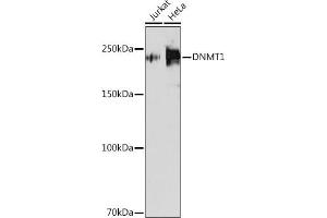 Western blot analysis of extracts of various cell lines, using DNMT1 antibody (ABIN7266808) at 1:1000 dilution. (DNMT1 抗体)