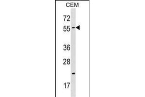 CBX4 Antibody (N-term) (ABIN1538811 and ABIN2848679) western blot analysis in CEM cell line lysates (35 μg/lane). (CBX4 抗体  (N-Term))