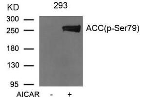 Western blot analysis of extracts from 293 cells untreated or treated with AICAR using Acetyl-CoA Carboxylase (Phospho-Ser79) Antibody. (Acetyl-CoA Carboxylase alpha 抗体  (pSer79))