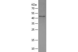 Western Blotting (WB) image for Ankyrin Repeat and SOCS Box Containing 17 (ASB17) (AA 76-295) protein (His-IF2DI Tag) (ABIN7283405) (ASB17 Protein (AA 76-295) (His-IF2DI Tag))