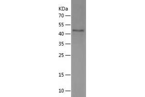 ASB17 Protein (AA 76-295) (His-IF2DI Tag)