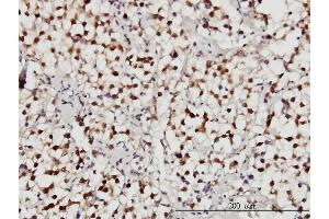 Immunoperoxidase of monoclonal antibody to USP34 on formalin-fixed paraffin-embedded human seminoma. (USP34 抗体  (AA 3296-3395))