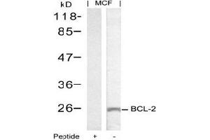 Image no. 2 for anti-B-Cell CLL/lymphoma 2 (BCL2) (Ser70) antibody (ABIN197204) (Bcl-2 抗体  (Ser70))