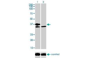Western blot analysis of TCF19 over-expressed 293 cell line, cotransfected with TCF19 Validated Chimera RNAi (Lane 2) or non-transfected control (Lane 1). (TCF19 抗体  (AA 17-102))