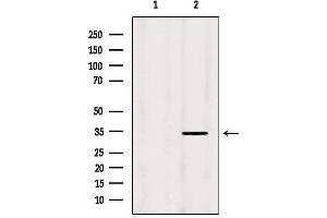 Western blot analysis of extracts from Hela, using MRPL19 Antibody. (MRPL19 抗体  (Internal Region))