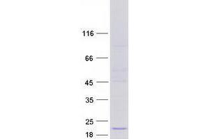 Western Blotting (WB) image for Ubiquitously-Expressed, Prefoldin-Like Chaperone (UXT) (Transcript Variant 2) protein (Myc-DYKDDDDK Tag) (ABIN2735157)