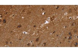 Immunohistochemistry of paraffin-embedded Human brain using FRK Polyclonal Antibody at dilution of 1:50 (FRK 抗体)