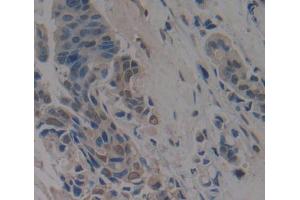 Used in DAB staining on fromalin fixed paraffin- embedded breast cancer tissue (Anoctamin 2 抗体  (AA 823-1003))