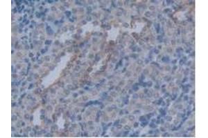 Detection of AQP4 in Rat Kidney Tissue using Polyclonal Antibody to Aquaporin 4 (AQP4) (Aquaporin 4 抗体  (AA 179-314))