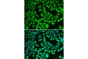 Immunofluorescence analysis of MCF-7 cells using PSMD7 antibody. (PSMD7 抗体  (AA 1-324))