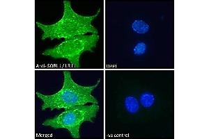 ABIN184579 Immunofluorescence analysis of paraformaldehyde fixed HepG2 cells, permeabilized with 0. (SORL1 抗体  (C-Term))