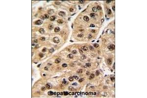 Immunohistochemistry (Paraffin-embedded Sections) (IHC (p)) image for anti-Polymerase (RNA) I Polypeptide C, 30kDa (POLR1C) (AA 319-346), (C-Term) antibody (ABIN389351)