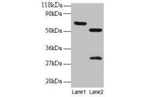 Western blot All lanes: ZNF384 antibody at 2 μg/mL Lane 1: EC109 whole cell lysate Lane 2: 293T whole cell lysate Secondary Goat polyclonal to rabbit IgG at 1/15000 dilution Predicted band size: 64, 57, 51 kDa Observed band size: 64, 51, 30 kDa (ZNF384 抗体  (AA 1-245))