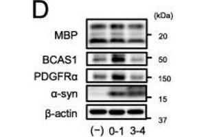 α-Syn PFF exposure to immature OLGs during differentiation-induced abnormal oligodendrogenesis. (BCAS1 抗体  (AA 542-584))