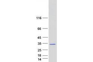 Western Blotting (WB) image for RAB34, Member RAS Oncogene Family (RAB34) (Transcript Variant 1) protein (Myc-DYKDDDDK Tag) (ABIN2730330)