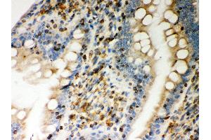 Anti- STIM1 Picoband antibody, IHC(P) IHC(P): Rat Intestine Tissue (STIM1 抗体  (N-Term))