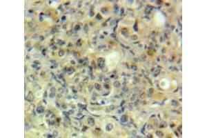Used in DAB staining on fromalin fixed paraffin-embedded Ovary tissue (GRK5 抗体  (AA 304-532))