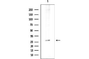 anti-Ladybird Homeobox 1 (Lbx1) antibody