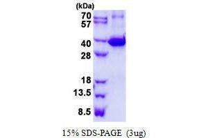 Figure annotation denotes ug of protein loaded and % gel used. (Galectin 9 蛋白)