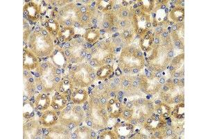 Immunohistochemistry of paraffin-embedded Mouse kidney using SMAD9 Polyclonal Antibody at dilution of 1:100 (40x lens). (SMAD9 抗体)
