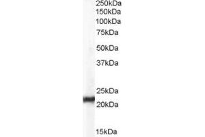 Western Blotting (WB) image for anti-Chromosome 15 Open Reading Frame 26 (C15orf26) (Middle Region) antibody (ABIN2785319) (C15orf26/CFAP161 抗体  (Middle Region))