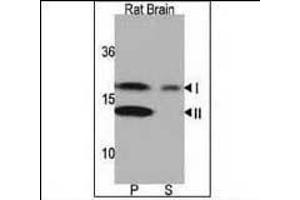 Western Blotting (WB) image for anti-Microtubule-Associated Protein 1 Light Chain 3 alpha (MAP1LC3A) (AA 1-30), (N-Term) antibody (ABIN388464)