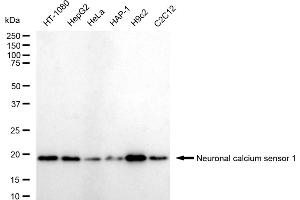 Western blotting analysis using Neuronal calcium sensor 1 antibody (ABIN7799584). (Recombinant NCS1 抗体)