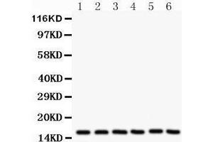 Western Blotting (WB) image for anti-Superoxide Dismutase 1, Soluble (SOD1) (AA 116-146), (C-Term) antibody (ABIN3043438)