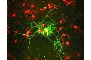 Immunostaining of cultured rat neurons showing labeling of NF-M (green) in mature neurons. (NEFM 抗体  (C-Term))