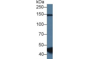 Detection of RBM20 in Porcine Skeletal muscle lysate using Polyclonal Antibody to RNA Binding Motif Protein 20 (RBM20) (RBM20 抗体  (AA 1089-1227))