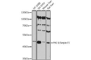 Western blot analysis of extracts of various cell lines, using PAI-1/Serpin E1 antibody (ABIN6131329, ABIN6147600, ABIN6147602 and ABIN6215676) at 1:3000 dilution. (PAI1 抗体  (AA 24-158))