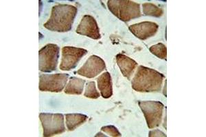 Formalin-fixed and paraffin-embedded human skeletal muscle reacted with DIPA Antibody , which was peroxidase-conjugated to the secondary antibody, followed by DAB staining. (CCDC85B 抗体  (Middle Region))