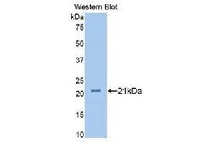 Western Blotting (WB) image for anti-Fibulin 1 (FBLN1) (AA 347-521) antibody (ABIN1175708) (Fibulin 1 抗体  (AA 347-521))
