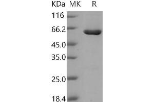 CSNK2A2 Protein (GST tag,His tag)