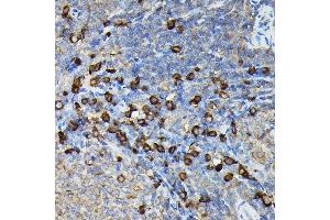 Immunohistochemistry of paraffin-embedded rat spleen using FA Rabbit pAb (ABIN7267102) at dilution of 1:100 (40x lens). (FAM117A 抗体)