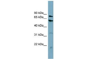 WB Suggested Anti-CPT1B Antibody Titration:  0. (CPT1B 抗体  (Middle Region))