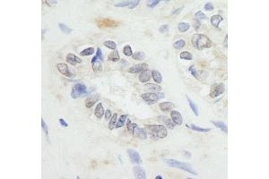 Immunohistochemistry (IHC) image for anti-Ring Finger Protein 20 (RNF20) (AA 125-175) antibody (ABIN7448779) (RNF20 抗体  (AA 125-175))