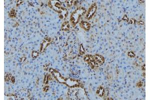ABIN6272870 at 1/100 staining Mouse kidney tissue by IHC-P. (IFT140 抗体  (Internal Region))