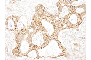 Immunohistochemistry (IHC) image for anti-Catenin, beta (CATNB) (AA 760-781) antibody (ABIN7448432) (beta Catenin 抗体  (AA 760-781))