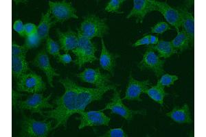 Immunofluorescence anti-CLTC Ab Membrane Vesicle Marker in Hepa1-6 Cells at 1/50 dilution, Cells were fixed With methanol, (Clathrin Heavy Chain (CLTC) (N-Term) 抗体)