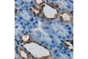 Immunohistochemical analysis of GSTT1 staining in human kidney formalin fixed paraffin embedded tissue section. (GSTT1 抗体)