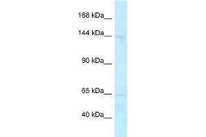 WB Suggested Anti-MYBBP1A Antibody Titration: 1. (MYBBP1A 抗体  (C-Term))