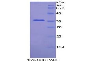 SDS-PAGE analysis of Rat NEK2 Protein. (NEK2 蛋白)