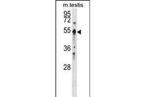 Western Blotting (WB) image for anti-Protein tyrosine Phosphatase, Non-Receptor Type 1 (PTPN1) (AA 221-249) antibody (ABIN1881705)